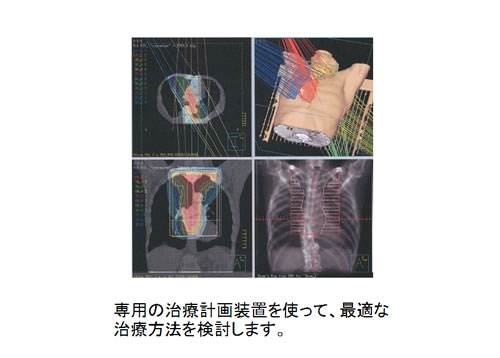 治療計画