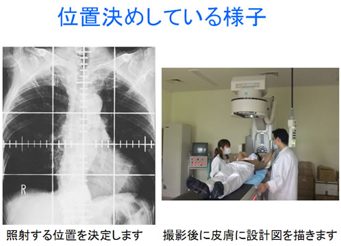 位置決めしている様子