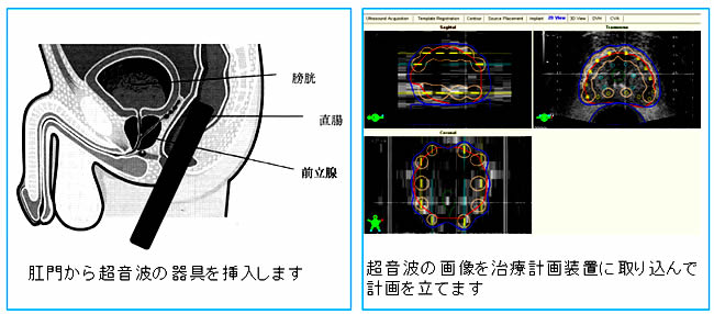 術前検査