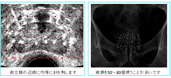 手術