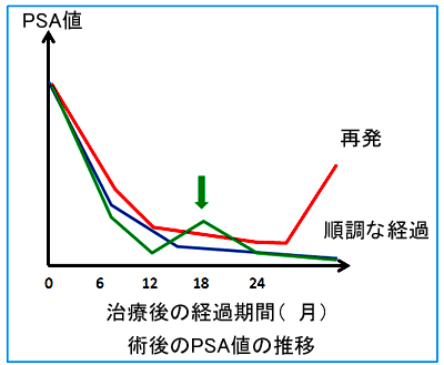 術後検査