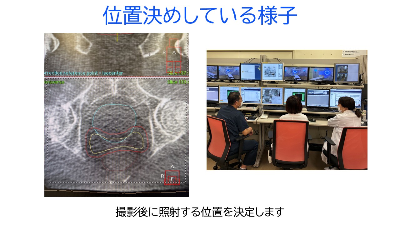 位置決めしている様子