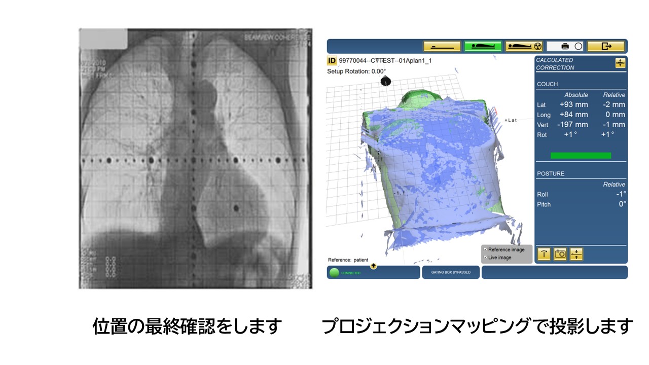 治療前の最終確認