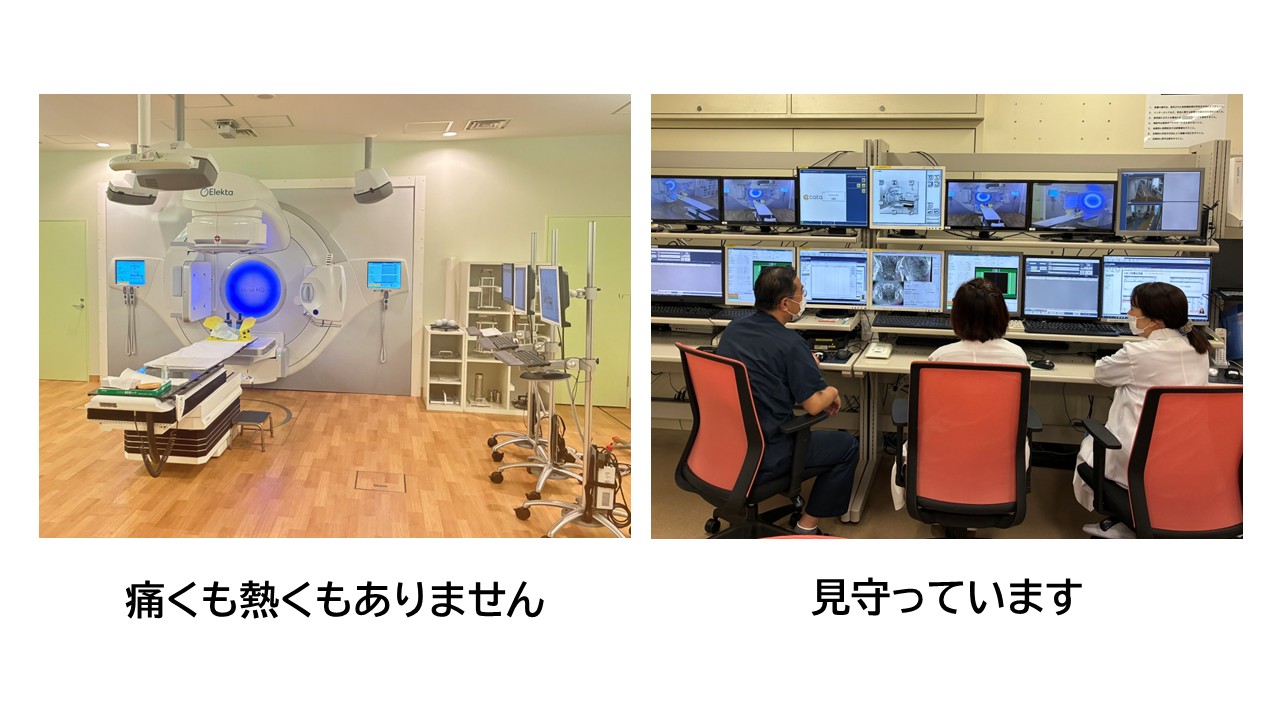 実際の照射